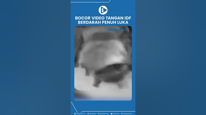 Bocor Video Tangan IDF Berdarah Penuh Luka