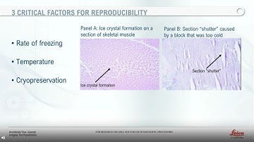 Histology Hacks For Cryosectioning