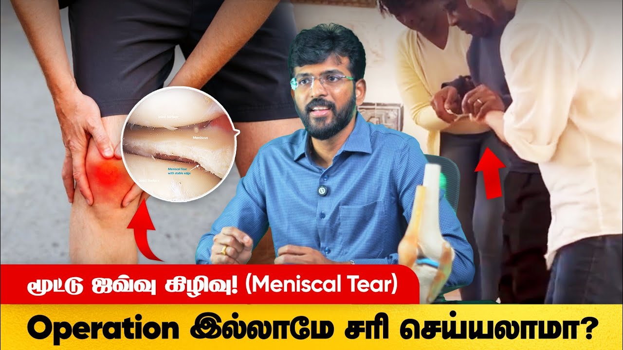 Meniscus Tear (மூட்டு ஜவ்வு கிழிவு) Causing Knee Pain? | Complete Diagnosis & Treatment.
