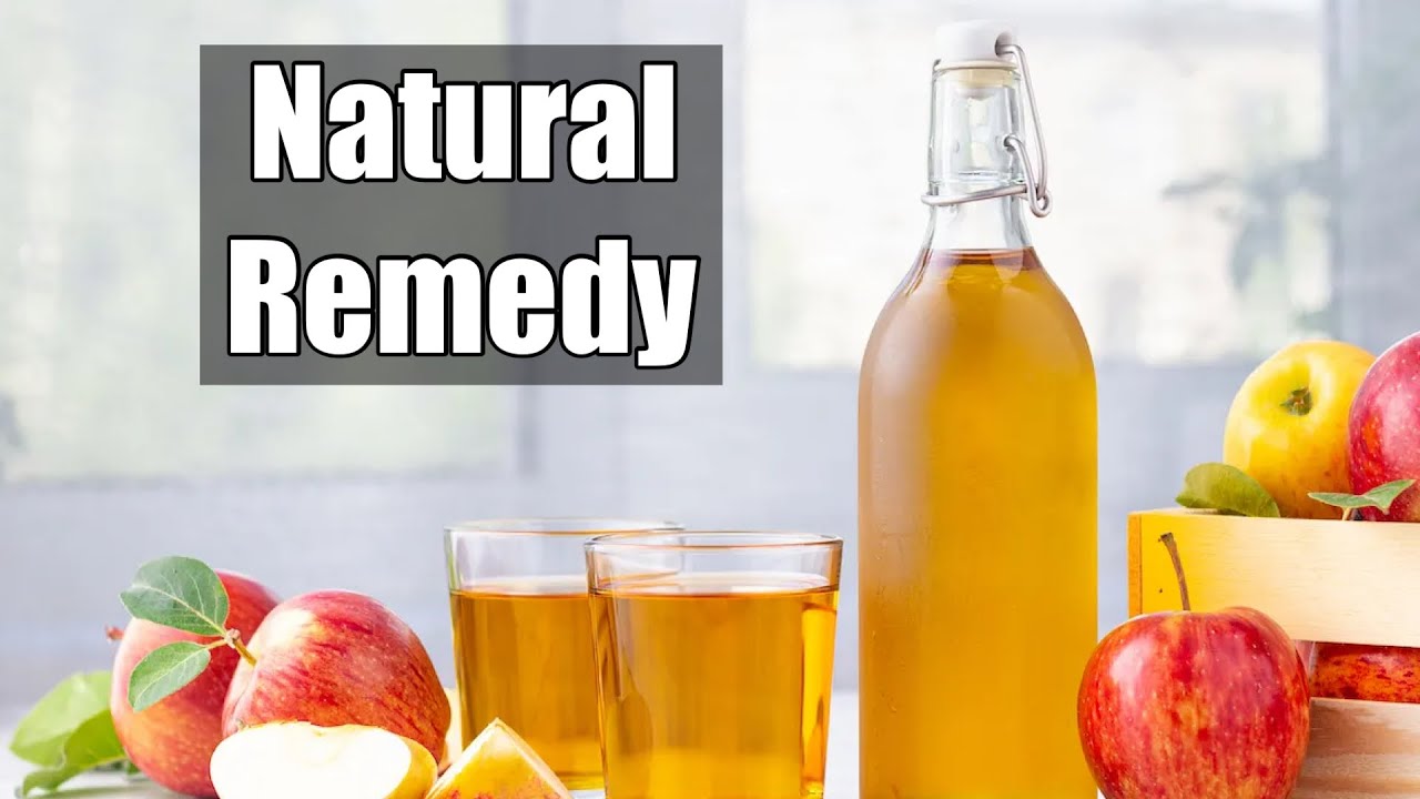 Apple Cider Vinegar To Treat Psoriasis YouTube