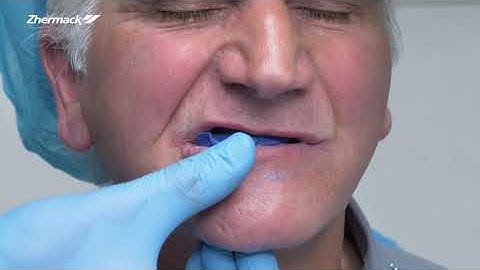 Dental Clinical Procedure for Complete Removable Prosthesis - Chapter 4: Bite Registration