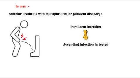 Gonorrhea - Causes, Signs & Symptoms, Diagnosis, And Treatment