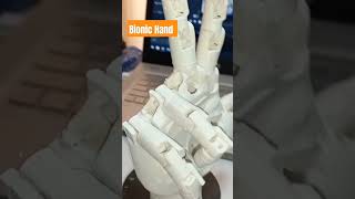 bionic hand