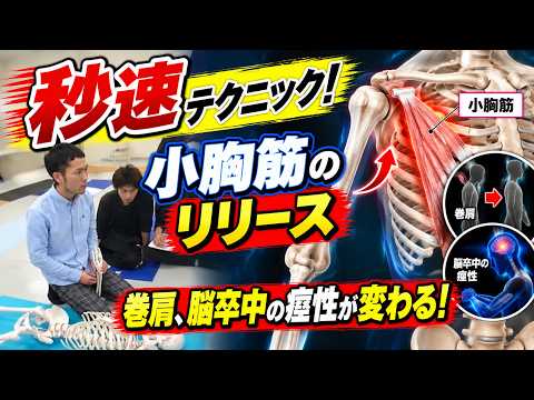 小胸筋のリリース（上肢の治療技術動画）