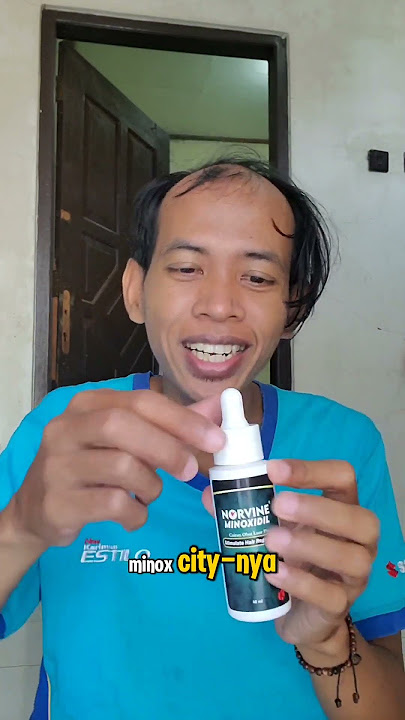 Hari pertama pemakaian minoxidil #sharingrambut #hairtreatment #minoxidil