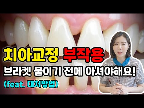   치아교정 부작용 한두개가 아닙니다