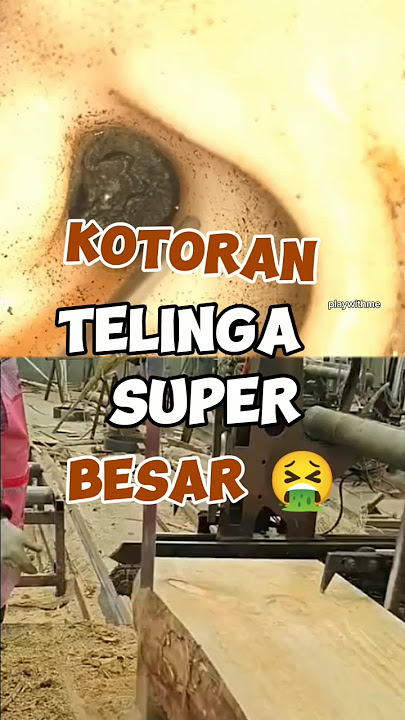 Pernah Lihat Kotoran Telinga Sebesar Ini ?? 🤮🤮 #short #shortsvideo #satisfying #asmrcleaning #tips