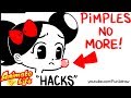 10 Ways to "Get Rid Of" PIMPLES! | Animate My Life HACKS