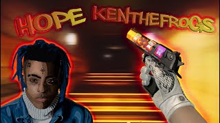 ❤️ XXXTENTACION - HOPE ❤️ | A CSGO MONTAGE