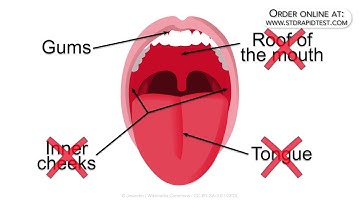 How to use an iCare HIV ORAL test kit  -  by LT Labs
