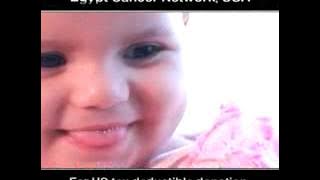 CCHE 57573 Patient Janna, Egypt Cancer Network 57357, USA
