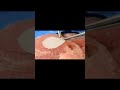 Surgical Practice with 3D Printed Models
