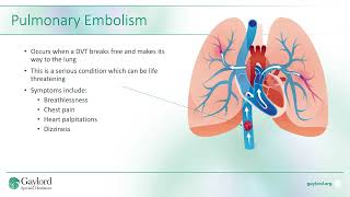 SCI Education Series: DVT and PE