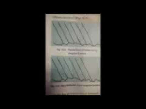 Regular and Diffused reflection