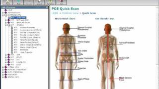 Posture Analysis Software Strategies