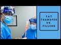 Why I Choose Fat Transfer over Fillers Almost Every Time