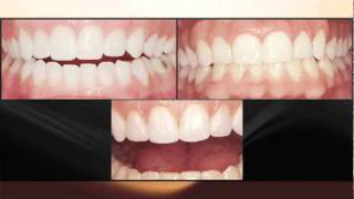 Vit-l-escence Part 2.flv