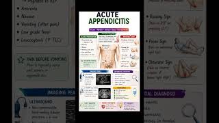acute appendicitis #pyt #pyqs #usmle #upsccms #inicet #fmge #neetpg #surgery #radio #highyieldtopics