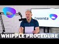 What is the Whipple Procedure - Causenta Cancer Treatment Center