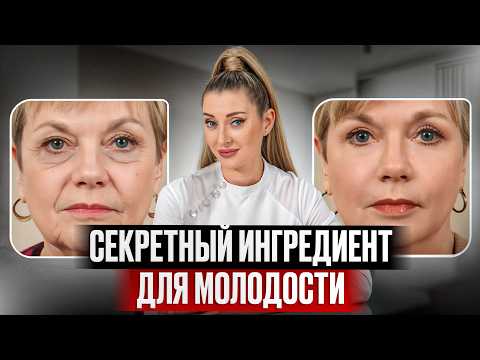РЕАЛЬНО ли подтянуть кожу БЕЗ ОПЕРАЦИЙ?! / Вся ПРАВДА о полимолочной кислоте