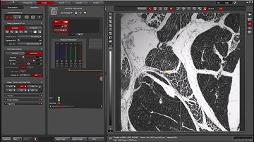 How do I align my camera?