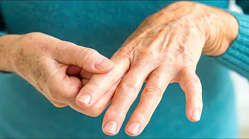 Quais são os primeiros sintomas da artrite?