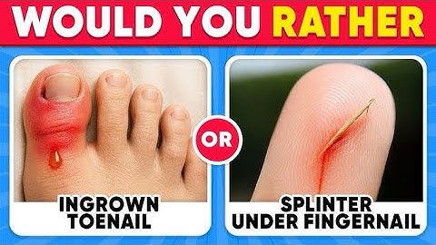 Would You Rather Challenge 🥶🔥 | 50 Brutal Choices That Break Your Brain!