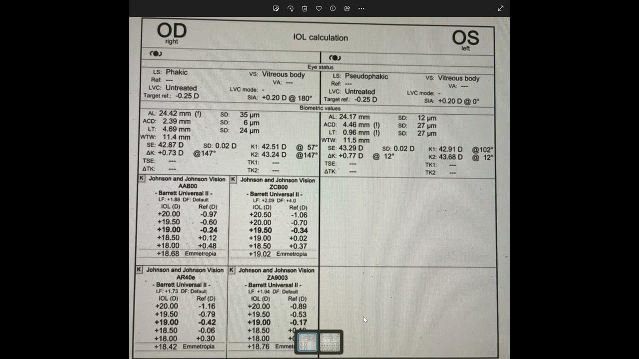 Lens thickness biometry and barrett universal 2 formula youtube