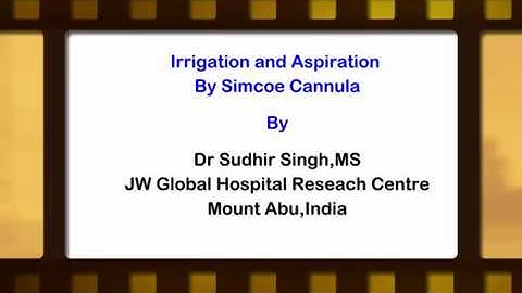 Irrigation Aspiration by Using Simcoe Cannula Dr Sudhir Singh
