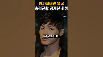 망가져버린 얼굴 충격근황 공개한 휘성 