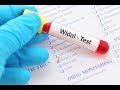 Microbiology   interpretation of widal test labsforlifeproject