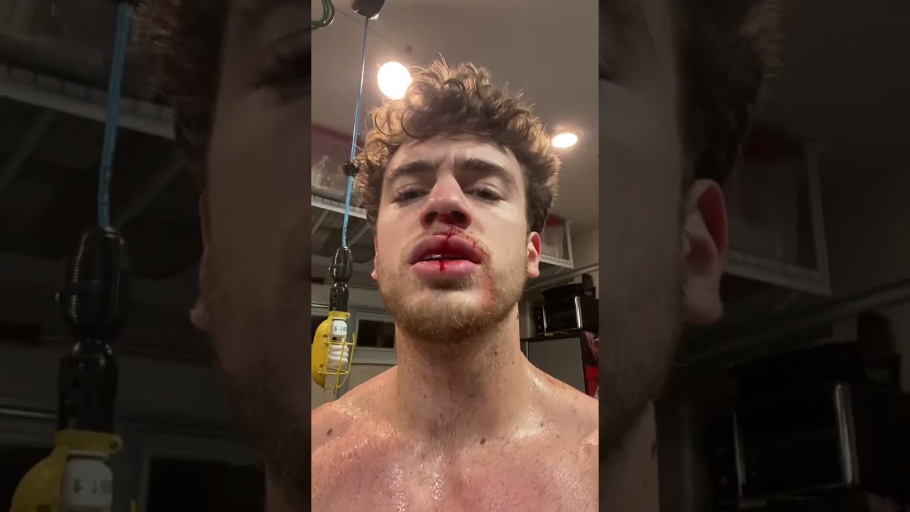 Part 2 Why Am I Bl33ding Health Capcut Icebath Blood Coldplunge