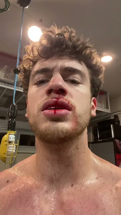 Part 2: why am I bl33ding? #health #capcut #icebath #blood #coldplunge