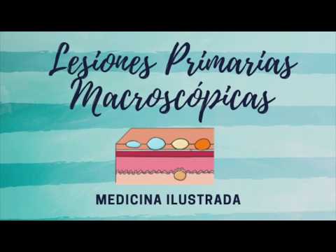 Video: ¿Qué son las máculas y las pápulas?