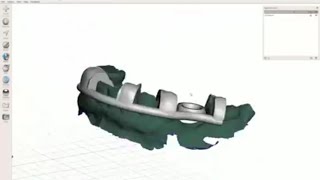 BlueSkyPlan Guide - Segmental Tube Guide Design