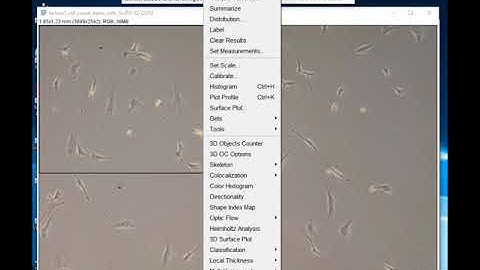 Cell counting and scale bars using ImageJ