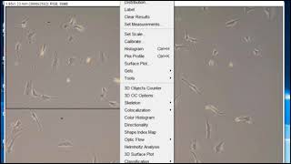Cell counting and scale bars using ImageJ