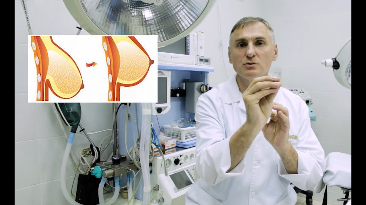 Подтяжка грудей | 5 Методов | Операция по увеличению грудей - YouTube