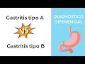 Diagnóstico Diferencial. Gastritis tipo A vs Gastritis tipo B