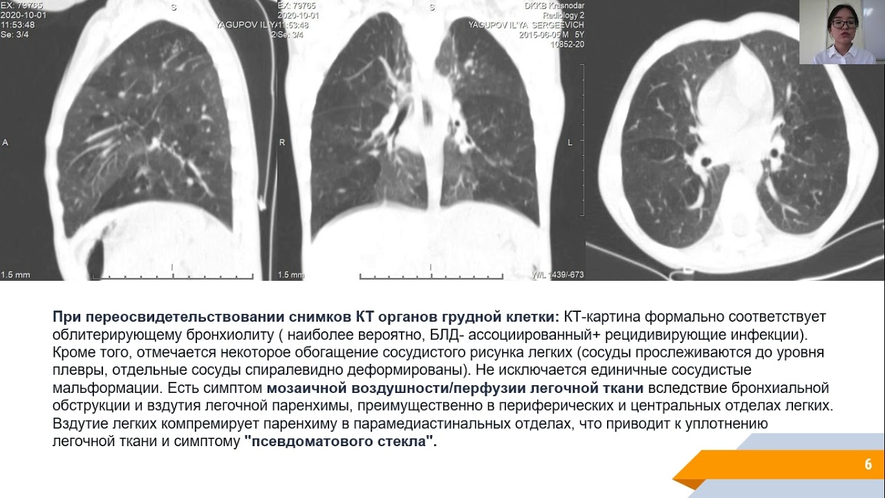 36 Бакирова Мээрим Данияровна- ординатор 2 года кафедры пропедевтики детских болезней, Москва