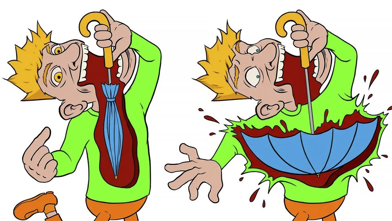 Самые нелепые смерти в истории человечества