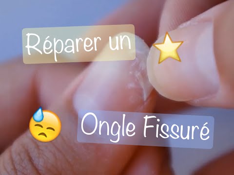 Vidéo: Ongles Fissurés: Causes, Réparation Et Prévention