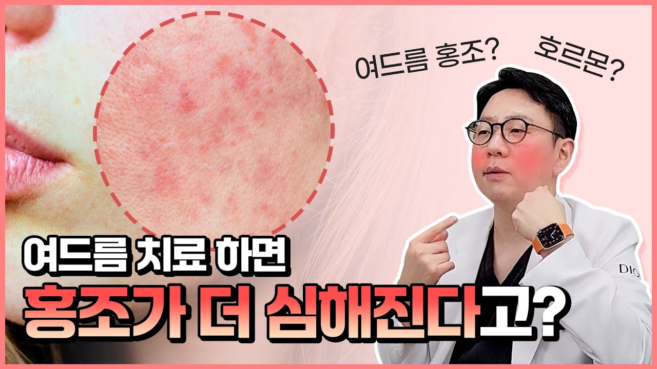 안면홍조 원인부터 알고 관리해야 합니다! | 홍조 관리 - YouTube