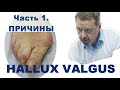 Косточки - hallux valgus.  Мастер-класс. Часть 1. Причины возникновения. Андрей Найдек.