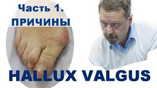 Косточки - hallux valgus.  Мастер-класс. Часть 1. Причины возникновения. Андрей Найдек.