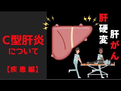 第33回【肝臓専門医解説】C型肝炎について【疾患編】