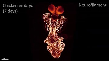 Flying through a cleared chicken embryo with a mesoSPIM