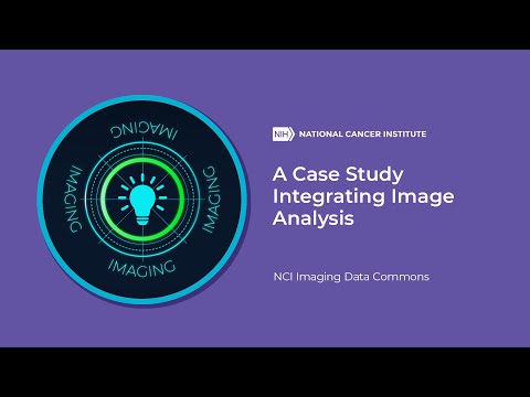 A Case Study Integrating Image Analysis, NCI Imaging Data Commons