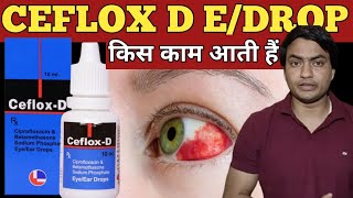 Ceflox Dee Ceflox Dee Eye Drops Ceflox Dee Eye Drops Eye Flu Ceflox Dee Ear Drops