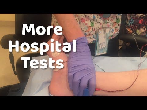 What to expect during Nerve Conduction Study and EMG test